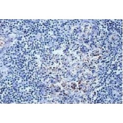 AF4/FMR2 Family Member 3 (AFF3) Antibody