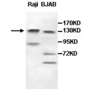 WB analysis of Raji and BJAB cell lysates, using AFF3 Antibody (1/500 dilution).