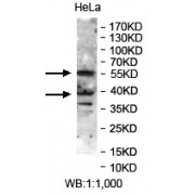 Western blot analysis of HeLa cell lysates, using GNAL antibody (1/1000 dilution).