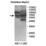 Western blot analysis of fetal liver and HepG2 cell lysate, using BTNL2 antibody.