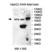 Western blot analysis of HepG2, A549 and fetal brain lysates, using SNTG2 antibody.