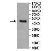 WB analysis of HeLa cell lysate, using SMOC1 Antibody (1/1000 dilution).