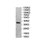 WB analysis of recombinant protein, using ATP9B Antibody. Predicted band size: 37 kDa.