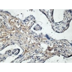 Prickle-Like Protein 1 (PRICKLE1) Antibody