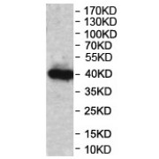 WB analysis of the recombinant protein.