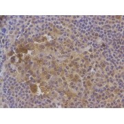 IHC-P analysis of human tonsil tissue, with cytoplasmic staining, using DOCK5 antibody (1/100 dilution).