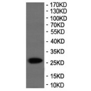 WB analysis of HeLa cell lysate transfected with EGFP-tagged protein vector.