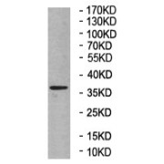 WB analysis of rat liver tissue lysate.