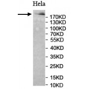 Westen blot analysis of cellular extract of HeLa lysate, using NUMA1 antibody (1/500 dilution).