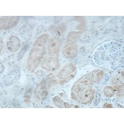 Kelch-Like Protein 38 (KLHL38) Antibody