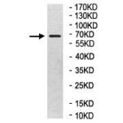 WB analysis of Human kidney tissue lysate, using KLHL38 antibody (1/1000 dilution).