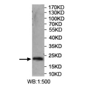 Western blot analysis of recombinant protein using SYT14 Antibody. Predicted band: 21 kDa.