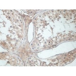 Coiled-Coil Domain Containing 103 (CCDC103) Antibody