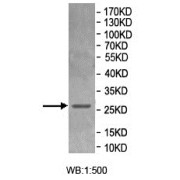 WB analysis of recombinant Human CCDC103. Predicted band size: 27 kDa.