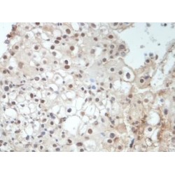 Receptor Tyrosine Kinase Like Orphan Receptor 2 (ROR2) Antibody