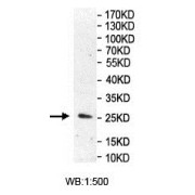 WB analysis of the recombinant protein, using ROR2 antibody. Predicted band size: 25 kDa.