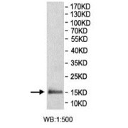 Western blot analysis of recombinant REEP4 protein, using REEP4 antibody. Predicted band size: 14 kDa.