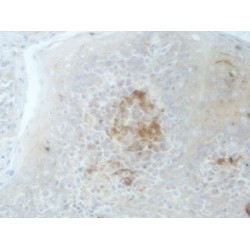 Methylcytosine Dioxygenase TET3 (TET3) Antibody