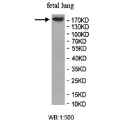 WB analysis of fetal lung lysate, using TET3 antibody