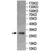 WB analysis of the recombinant protein, using MUCL1 antibody (1/500 dilution). Predicted band size: 29 kDa.