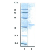 SDS-PAGE. Lane 1: Molecular Weight Markers. Lane 2: Catalogue Number abx060982. This protein is from Human Seminal Fluid.