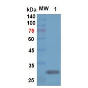 Western blot analysis of recombinant Mouse DMD.
