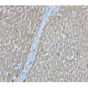 IHC-P analysis of human liver tissue (200X), using AFP antibody (1/200 dilution).