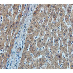 Alpha-Fetoprotein (AFP) Antibody