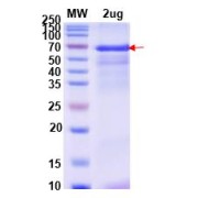 SDS-PAGE analysis of recombinant Pig Inactivated Complement Factor 3b Protein expressed in E. coli.