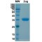 SARS-CoV-2 Spike Protein RBD (B.1.617 Variant)