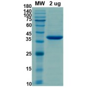 SDS-PAGE analysis of recombinant SARS-CoV-2 PL-Pro Protein.