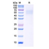 Monkeypox Virus Hemagglutinin (Mpox B2R) Protein