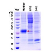 SDS-PAGE analysis of expression tests of the target protein using coomassie blue staining. The negative control is marked Ø. Briefly, the bacterial cells were collected by centrifugation. The supernatant (medium) was lysed in a buffer containing PBS, pH 7.5. After centrifugation, the soluble supernatnant fraction was collected (native protein extraction - NPE). The insoluble fraction was collected and solubilized with a denaturing buffer (8 M Urea). After centrifugation, the supernatant was collected (denatured protein extraction - DPE). The NPE and DPE fractions were analyzed by SDS-PAGE.  The target genes were transfected in HEK293 cells, 1.5 ml of culture medium and cells were collected on 6th day of post-transfection. After semi-purification, the optimal expression was observed in cultutre medium, NPE and DPE fraction.