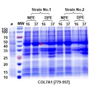 SDS-PAGE analysis of expression tests of the target protein. The negative control is marked Ø. Briefly, two E. coli strains (1 - BL21 (DE3), and 2 - T7E) were induced with 1 mM IPTG  at either 16 °C for 16 h, or at 37 °C for 4 h. The bacterial cells were collected by centrifugation. The supernatant (medium) was lysed in a buffer containing PBS, pH 7.5, and 10% glycerol. After centrifugation, the soluble supernatnant fraction was collected (native protein extraction - NPE). The insoluble fraction was collected and solubilized with a denaturing buffer (8 M Urea). After centrifugation, the supernatant was collected (denatured protein extraction - DPE). The NPE and DPE fractions were analyzed by SDS-PAGE. Based on these tests, the optimal expression was observed in strain 1 - BL21 (DE3) cells incubated with 1 mM IPTG at 37 °C for 4 h, NPE fraction.