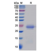 SDS-PAGE analysis of recombinant Human RHD Protein.