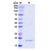 SDS-PAGE analysis of Gap Junction Alpha-5 Protein / CX40 (GJA5) protein.