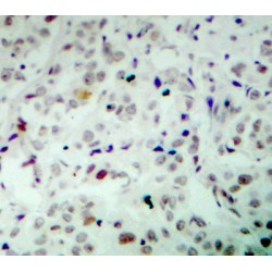 Retinoblastoma Protein 1 Phospho-Ser780 (RB1 pS780) Antibody