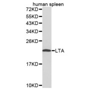 Western blot analysis of extracts of human spleen cell lines, using LTA antibody.