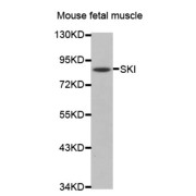 Western blot analysis of extracts of mouse fetal muscle tissue lysate, using SKI antibody.