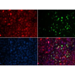 RAD18, E3 Ubiquitin Protein Ligase (RAD18) Antibody