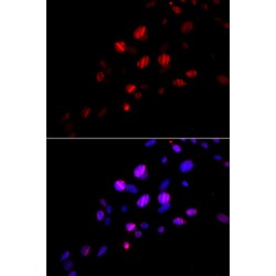 RAD18, E3 Ubiquitin Protein Ligase (RAD18) Antibody