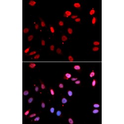 RAD18, E3 Ubiquitin Protein Ligase (RAD18) Antibody