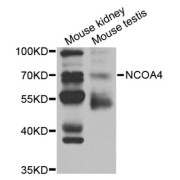 Western blot analysis of extracts of various cell lines, using NCOA4 antibody.