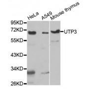 Western blot analysis of extracts of various cell lines, using UTP3 antibody.