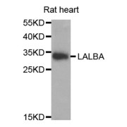 Western blot analysis of extracts of Rat heart cell line, using LALBA antibody.