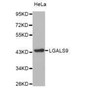 Western blot analysis of extracts of HeLa cell line, using LGALS9 antibody.