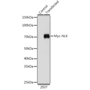 Western blot analysis of extracts of normal 293T cells and 293T transfected with Myc-NLK proteing, using Myc-Tag antibody (1/5000 dilution).