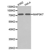 Mitogen-Activated Protein Kinase Kinase Kinase 7 (MAP3K7) Antibody