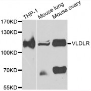 Very Low Density Lipoprotein Receptor (VLDLR) Antibody