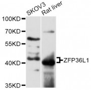 Western blot analysis of extracts of various cell lines, using ZFP36L1 antibody (1/3000 dilution).
